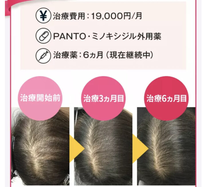 AGAヘアクリニック