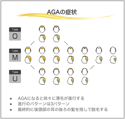 AGAの症状