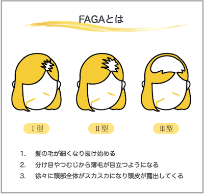 FAGAとは