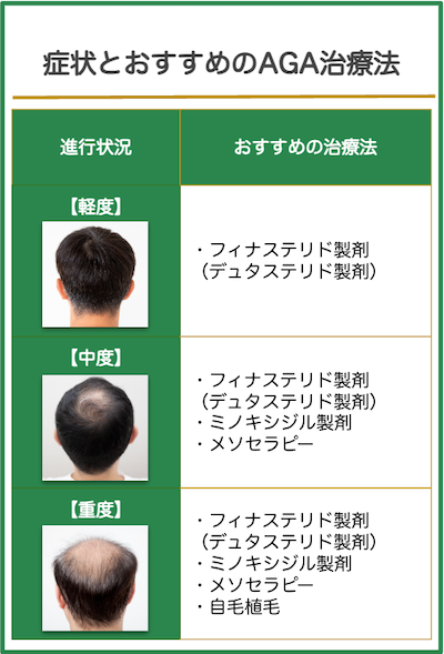 症状の進行状況とおすすめのAGA治療
