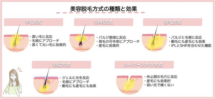 サロン脱毛の美容脱毛器の脱毛方式