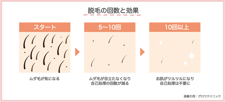 脱毛施術回数と効果