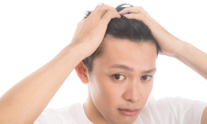 発毛、増毛薬、フォリックスとは？医師が効果や副作用について解説